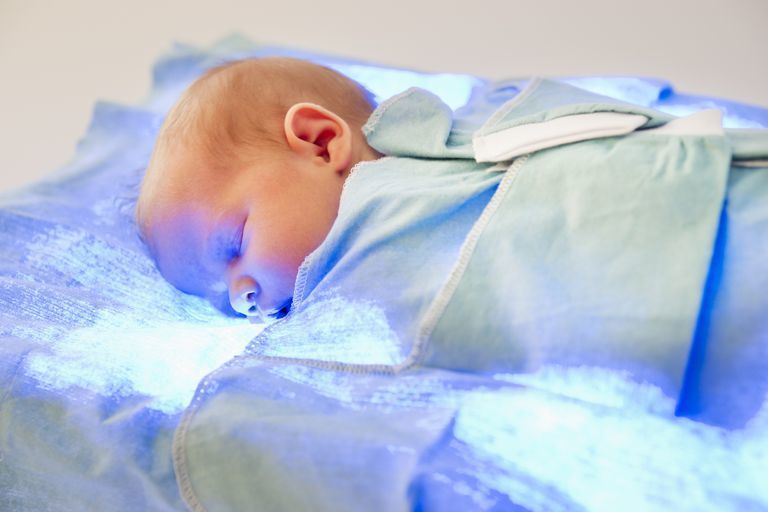 Seluk Beluk Fototerapi, Perawatan Bayi Kuning